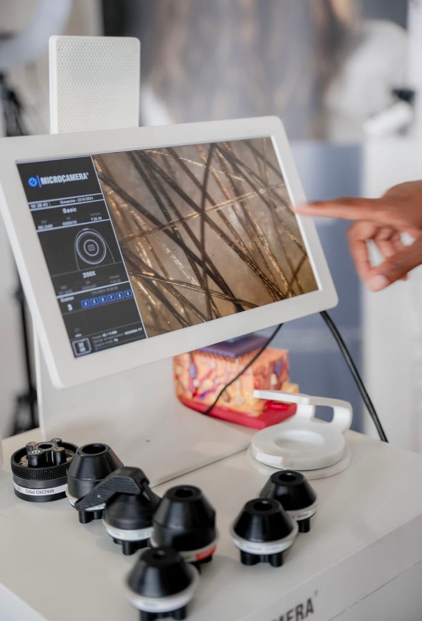 diagnostic capillaire